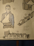 2024-07-24 (0612)  Schulrollkarte, Erste Hilfe Schienung von Hand und Arm / 60er Jahre / Bares für Rares Vintage